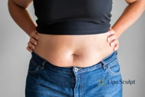 Do you wish you could reduce your muffin top Huddersfield With Aqualy fat dissolving injections you can!